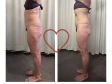 ハレ 麻布十番(Hare)の雰囲気(☆痩身極上リンパ+漢方ドーム+カッサ☆)