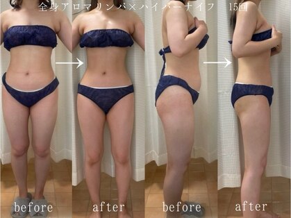 エン ボディアンドフェイシャル(En)の写真