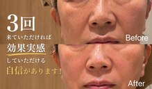 ソウ(SOW)