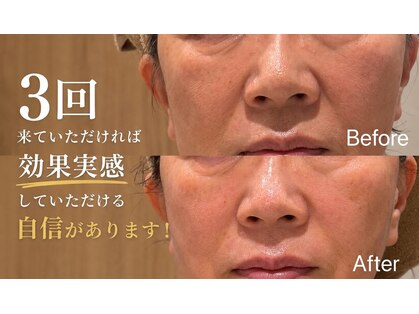 ソウ(SOW)の写真