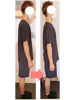 リベスト(RE:BEST)/当院の<全身矯正メニュー>効果