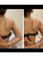 アトリエ ハルミナ(atelier harumina)/天使の羽根くっきり　背中　痩身