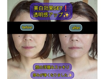 スノードロップ(snowdrop)/フェイシャルは小顔施術付き