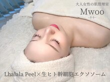 ムゥ(Mwoo)の雰囲気（公式認定を受けたララピール正規取扱店です◎肌質改善で毛穴撲滅）