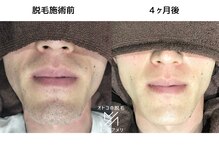メンズアメリ