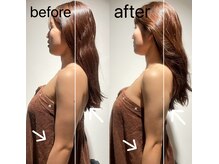 アンワインド(UNWIND)/骨を触らなくても変化します。