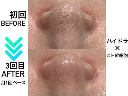 リンフェイス 横浜店(RINFACE)の写真