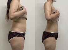 ビューティコア 二子玉川/本気の痩身を