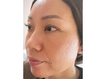 サロン ベレ プー(Salon Belle Peau)