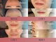 バース(Birth...)の写真