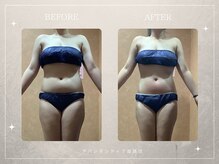 アバンダンティア 姫路店/理想のボディーラインへ