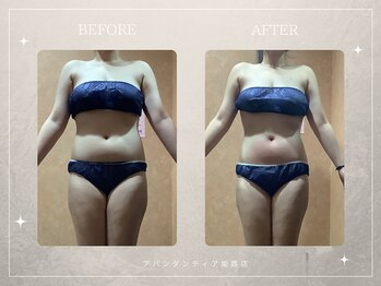 アバンダンティア 姫路店/理想のボディーラインへ