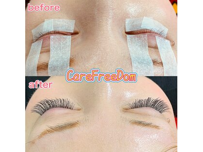 ケアフリーダム(CareFreeDom)の写真