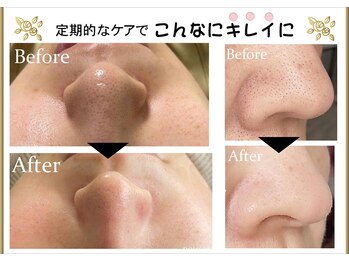 サロンフィーユ(Fille)/必ず2週間は空けて施術