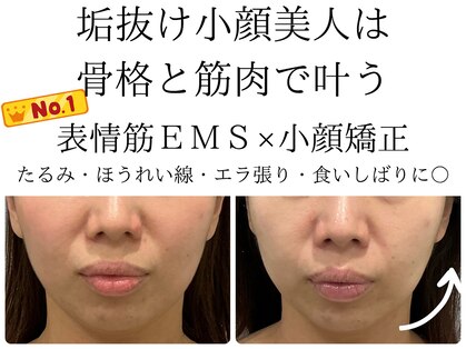 エミマス ボーテ(Emimas Beaute’)の写真