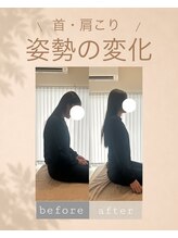 アオ 香椎(AO)/before→after