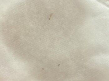 サクラ 伊勢原店(SAKURA)/ふき取り後にシミケアの垢が…