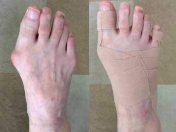 かず整骨院/足裏矯正ビフォーアフター！