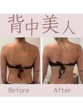 エステティックサロン ラ ベルタ(Esthetic Salon La Belta)/背中まで美しく！