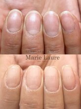 マリーロール 梅田店(Marie Laure)/深爪矯正/自爪育成/自爪風