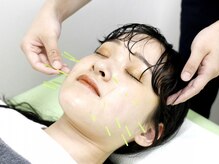 ノモコツ鍼灸 整骨院 雑色院(NOMOKOTSU鍼灸 整骨院)/+…施術風景…+　【美容鍼】