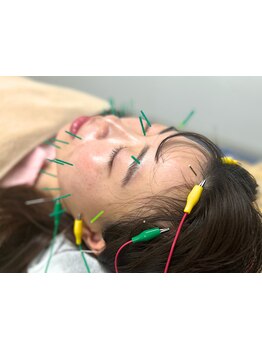 小顔になりたい