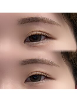 チル アンド アイ 船橋駅前店(Chill&Eye)/まつ毛パーマ+美眉スタイリング