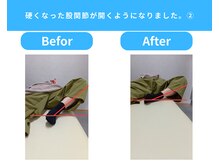 きくち整骨院/股関節が開くようになりました2
