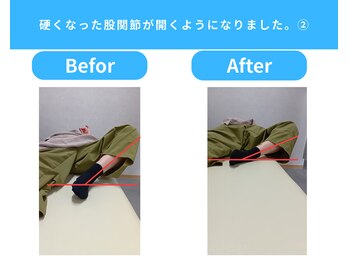 きくち整骨院/股関節が開くようになりました2