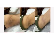 アネモネ ビューティーズ サロン(Anemone Beauty's salon)/ドールピンクBefore→After