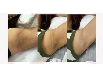 アネモネ ビューティーズ サロン(Anemone Beauty's salon)/ドールピンクBefore→After