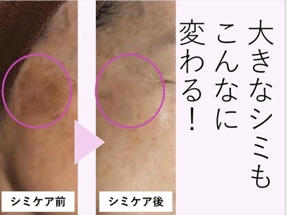 ミニョン(Mignon)の写真