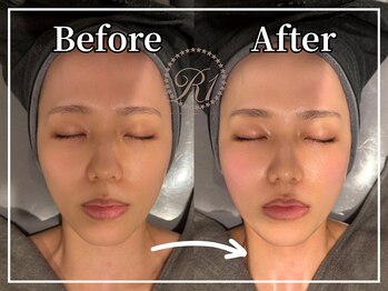 R-1ビューティーサロン 銀座/Before&After
