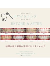 プラスビーセルフ(+b self)/ホワイトニング