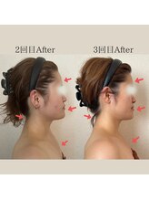 リーブル(LIBRE)/小顔コルギ　２回