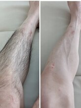 長寿鍼灸院 長寿整骨院/★全身つるスベ宣言★