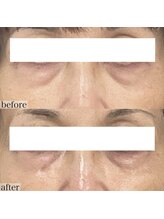 ヴェルシック(Belchic)/目元のケアもお任せください