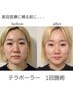 今話題の即小顔＆たるみケア【表情筋トレ！テラボーラー】