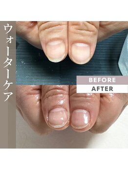 ネイルケア