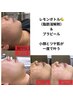 ツヤ肌も小顔も叶えたい！レモンボトルとプラピールがセットでお得