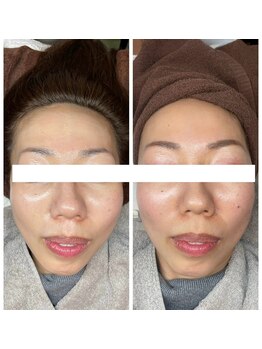 白雲木/速攻透明感☆