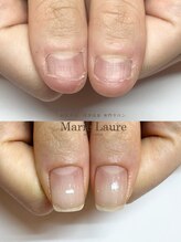 マリーロール 淀屋橋本店(Marie Laure)/深爪矯正/自爪育成/ネイルケア