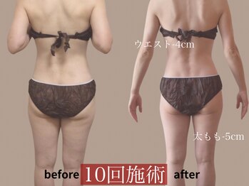 モア 多治見店(MORE)/お客様ビフォーアフター