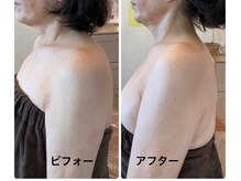 ナオフクオカ ヒーリングフォースエヌ(NaoFukuoka/healingforceN)/縮んでいた首も長く！