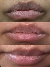 フェリス(FELIZ)/サロンケアで明るい口元