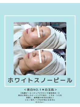 ソワナ(soina)/【神楽坂駅/フェイシャル/毛穴】