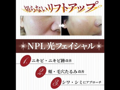 プリマジュールの写真