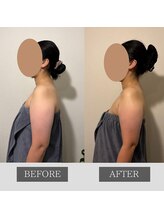 ツカ(TSUKA)/肩首スッキリ！美しい姿勢に☆