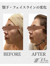 エフリア 大垣(F.lia)/フェイスライン、スッキリ★