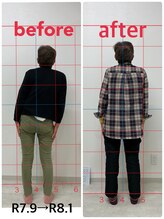 月の木整骨院/【施術後の変化】